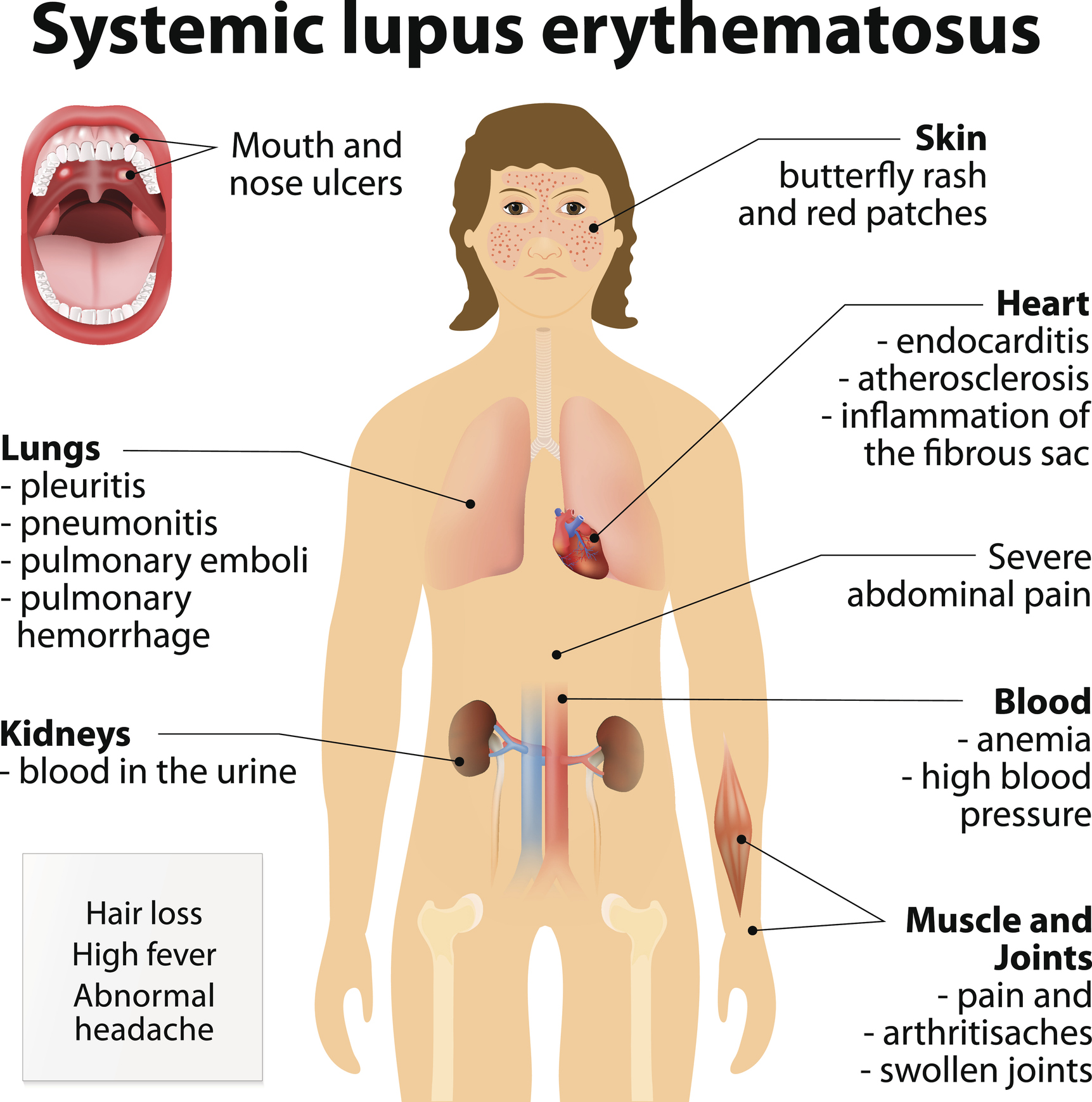 What Are Autoimmune Skin Diseases And How Do They Happen? - Enrich Clinic