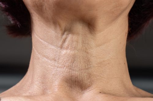 Neck  wrinkles and lines of senior woman. Facial and Neck Skin Aging Change on senior woman.